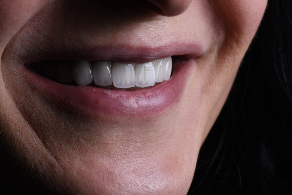 Portföyümüz dsc 2499